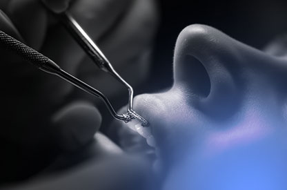 Kayseri implant
